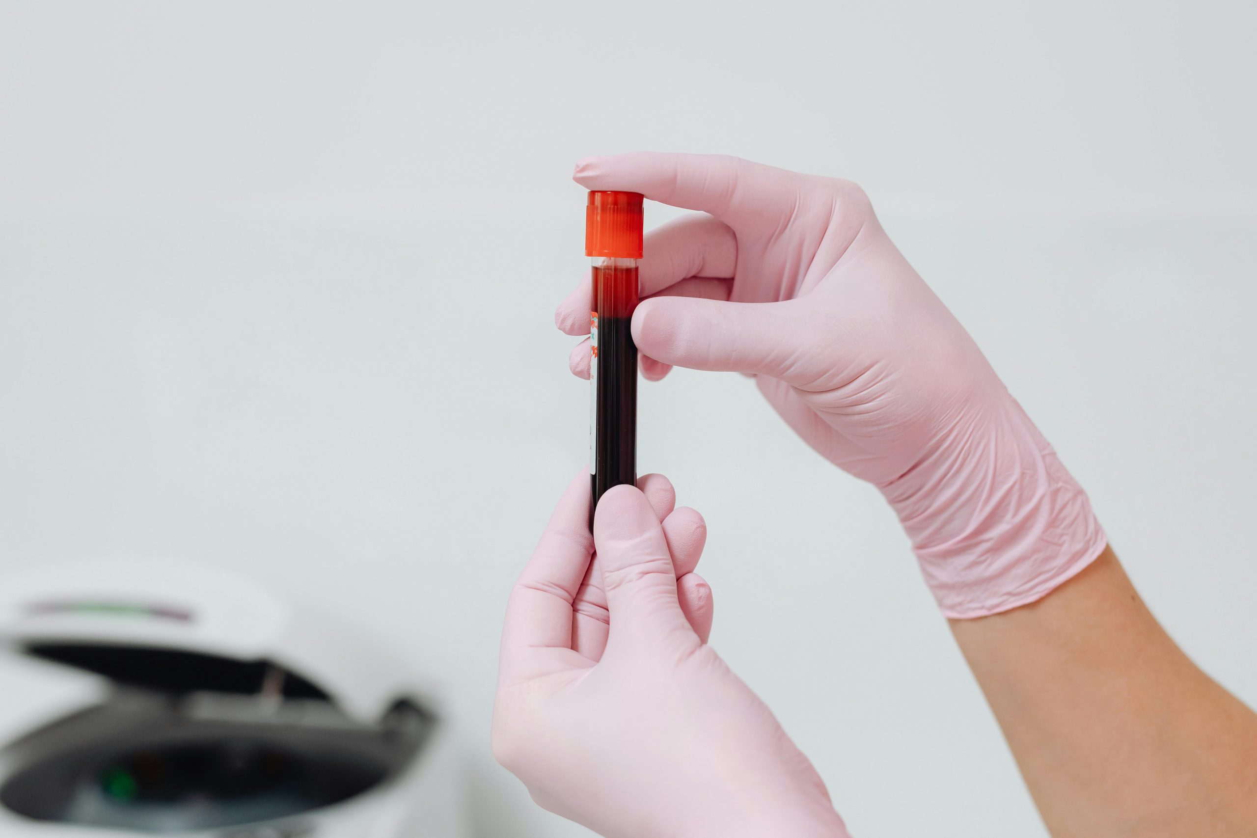 Inicio Close-up of gloved hands holding a blood sample in a test tube, ideal for medical and lab contexts.